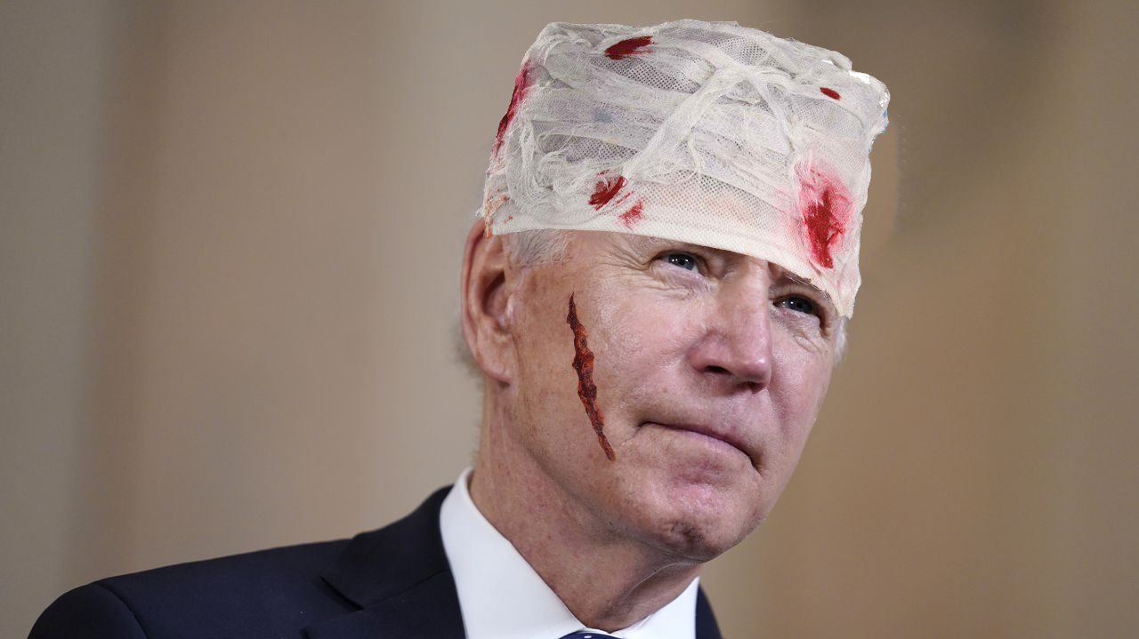 President Joe Biden gives a press conference with a gnarly gash in his face and head bandages